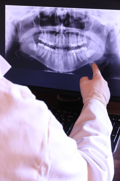 Best Emergency Tooth Extraction in South Dennis, NJ