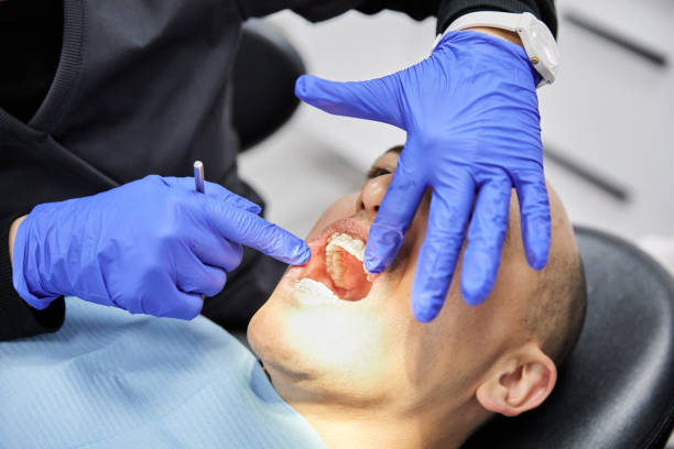 Best Emergency Wisdom Teeth Removal in South Dennis, NJ